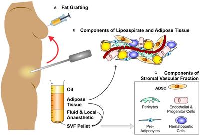 Fat Therapeutics: The Clinical Capacity of Adipose-Derived Stem Cells and Exosomes for Human Disease and Tissue Regeneration